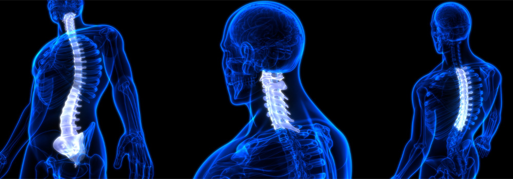 Complex Spine Diagrams